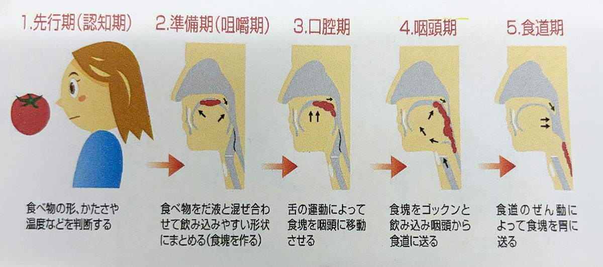 嚥下（飲み込み）の流れを5段階で示す図。①先行期（認知期）：食べ物の形・かたさ・温度などを判断する。②準備期（咀嚼期）：噛んで唾液と混ぜ、飲み込みやすい食塊を作る。③口腔期：舌の動きで食塊をのどへ送る。④咽頭期：ごっくんと飲み込み、食塊を咽頭から食道へ送る。⑤食道期：食道のぜん動運動で胃へ送る。