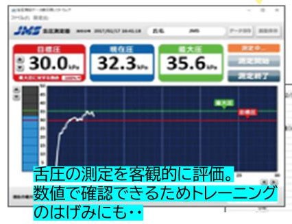 舌圧測定結果。舌圧の測定を客観的に評価。数値で確認できるためトレーニングの励みにも。