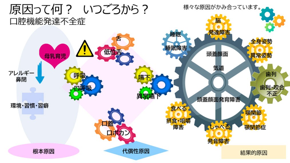 生活習慣や環境（例：アレルギーによる鼻づまり、口呼吸、低位舌など）が重なることで、呼吸・嚥下・姿勢のバランスが崩れ、口腔機能の発達不全につながる過程を示す図。その結果、顎の成長や筋肉の使い方が乱れ、歯列・咬合の不正（歯並びの乱れ）や顎関節の不調が起こりやすくなることを表している。